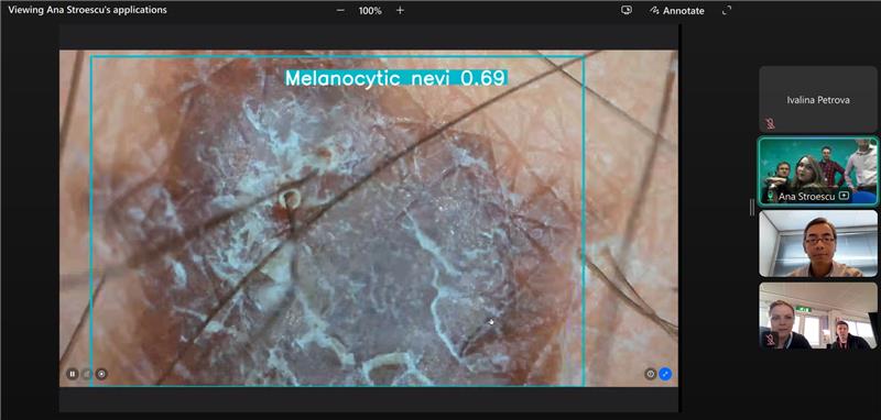 An image of a blemish on the skin